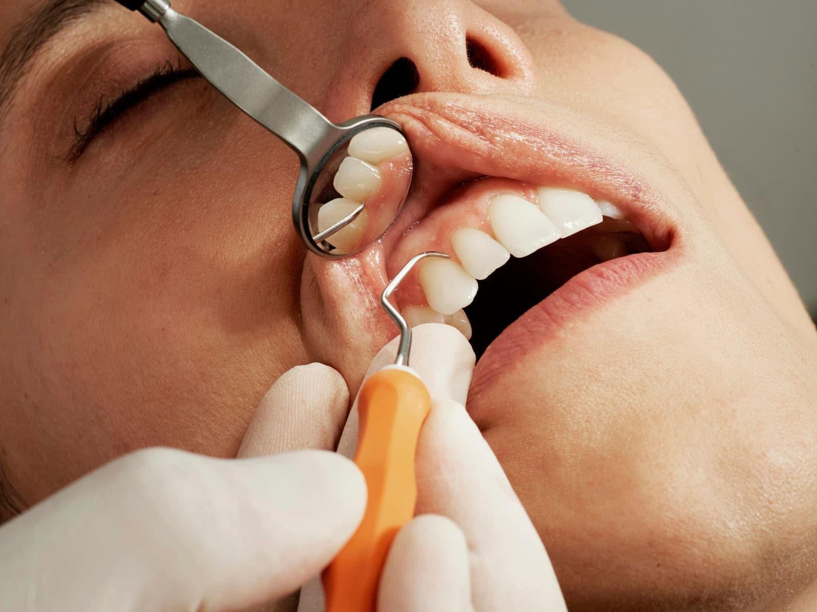 Close-up of a dental examination using a mirror and probe