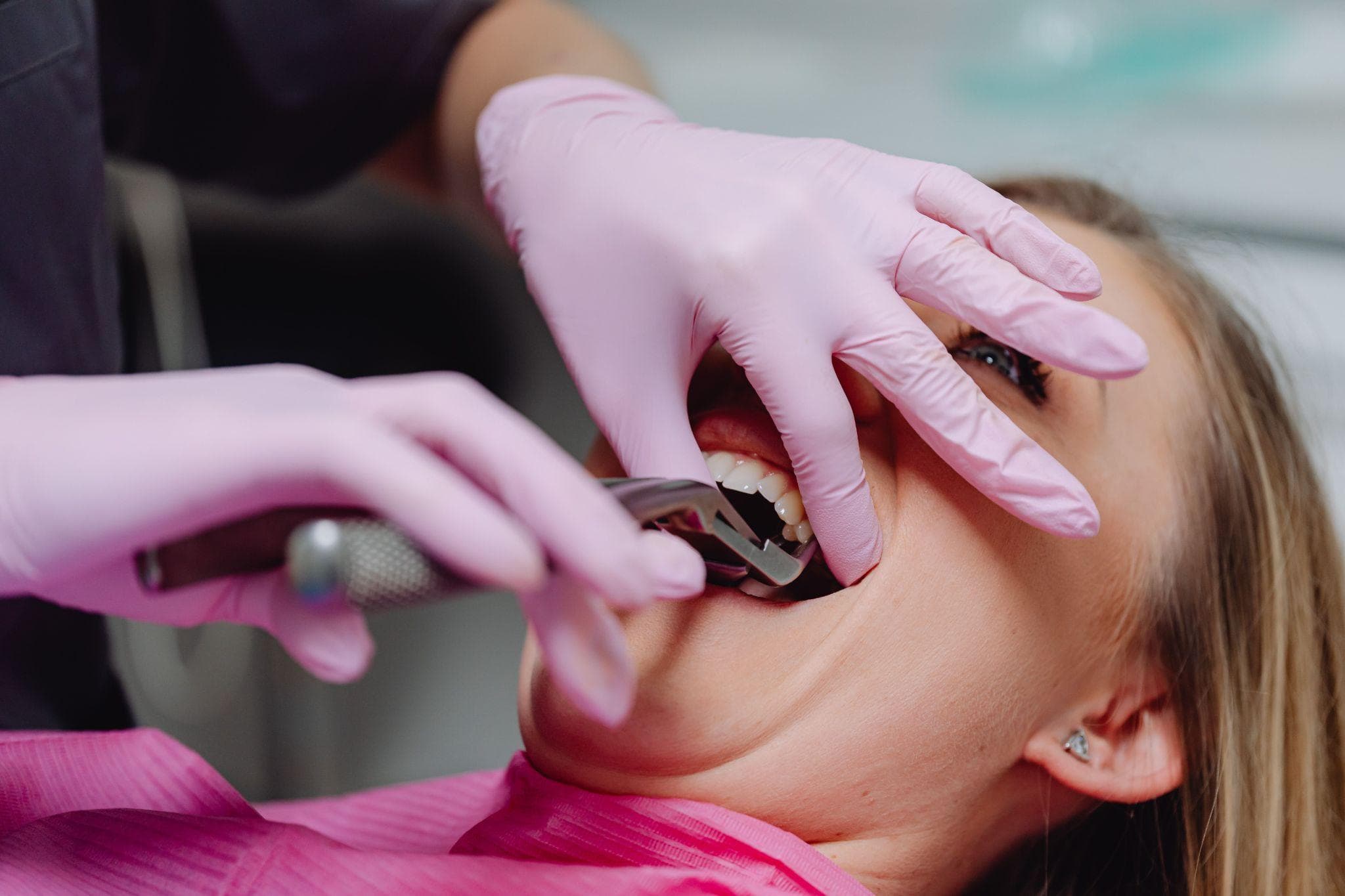 Dentist performing tooth extraction as an alternative to root canal