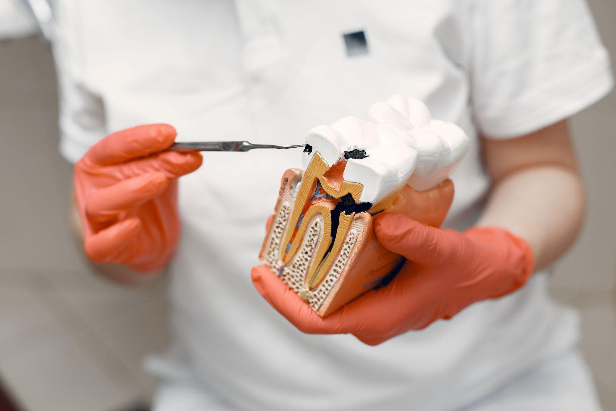 Dentist demonstrating root canal treatment using a tooth model