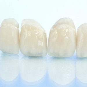 dental-crowns-penrith